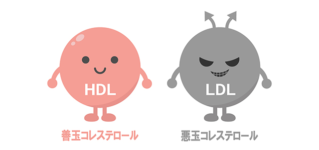 脂質異常症｜沈黙の動脈硬化を進行させる危険因子
